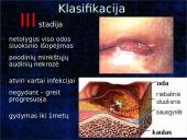 Pragulos ir jų gydymas 16 puslapis