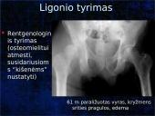 Pragulos ir jų gydymas 20 puslapis