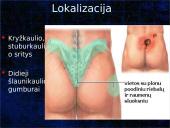 Pragulos ir jų gydymas 7 puslapis