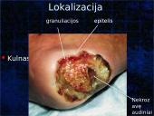 Pragulos ir jų gydymas 8 puslapis