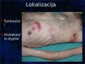 Pragulos ir jų gydymas 9 puslapis