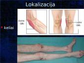 Pragulos ir jų gydymas 10 puslapis