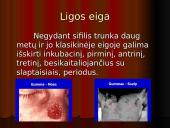 Sifilis - kas tai? 7 puslapis