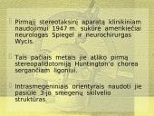 Stereotaksinis metodas 3 puslapis