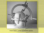 Stereotaksinis metodas 8 puslapis