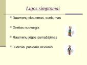 Su sunkiu fiziniu darbu susijusios ligos ir prevencija 16 puslapis