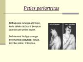 Su sunkiu fiziniu darbu susijusios ligos ir prevencija 5 puslapis