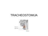 Tracheostomija