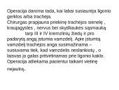 Tracheostomija 7 puslapis