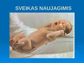 Tranzitorinės naujagimio būklės 11 puslapis