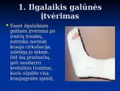 Trombozės rizikos veiksniai 4 puslapis