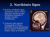 Trombozės rizikos veiksniai 5 puslapis