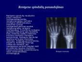 Elektromagnetiniai spinduliai 20 puslapis