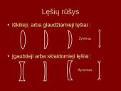 Lęšiai, akis, akiniai 6 puslapis