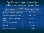 Liumbalinio ir epidūrinio tarpo punkcija 11 puslapis
