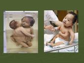 Radiacija ir jos poveikis žmogaus organizmui 9 puslapis