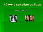 Rūkymas — pavojingas malonumas 7 puslapis