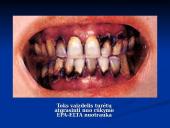 Rūkymo žala žmogui 14 puslapis