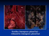 Rūkymo žala žmogui 15 puslapis