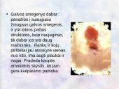 Vaisiaus vystymasis įsčiose 13 puslapis