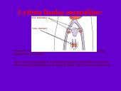 Endokrininių liaukų vystymosi anomalijos 13 puslapis