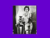 Endokrininių liaukų vystymosi anomalijos 15 puslapis