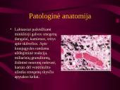 Intrauterinės infekcijos 12 puslapis