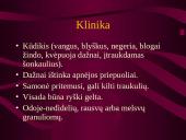 Intrauterinės infekcijos 18 puslapis