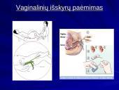 Makšties tepinėlio laboratorinis tyrimas 12 puslapis