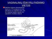 Makšties tepinėlio laboratorinis tyrimas 13 puslapis