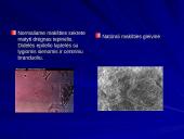 Makšties tepinėlio laboratorinis tyrimas 7 puslapis