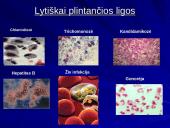 Makšties tepinėlio laboratorinis tyrimas 9 puslapis