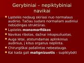 Onkologija ir navikai 8 puslapis