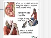 Perinatalinė infekcija 15 puslapis