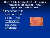 Rožė medicinoje 2 puslapis