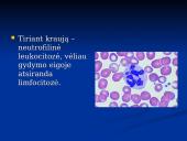 Rožė medicinoje 12 puslapis