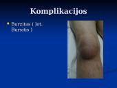 Rožė medicinoje 13 puslapis