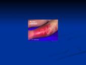 Rožė medicinoje 5 puslapis