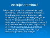Trombozė ir trombozės rizikos veiksniai 7 puslapis