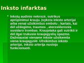 Trombozė be trombozės rizikos veiksniai 4 puslapis