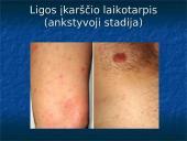 Žmonių riketsiozės 16 puslapis