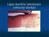 Žmonių riketsiozės 17 puslapis