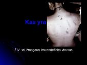 Lytiškai plintančios ligos: AIDS 2 puslapis