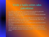 Informacinės technologijos, kompiuteris ir sveikata 13 puslapis