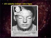 Ultravioletiniai saulės spinduliai 11 puslapis