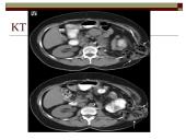 Įstrigusi išvarža 20 puslapis