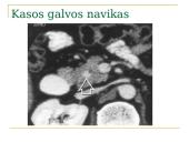 Kasos navikų diagnostika ir gydymas 10 puslapis