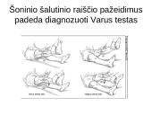 Kineziterapija po kelio sąnario raiščių pažeidimų 20 puslapis