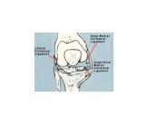 Kineziterapija po kelio sąnario raiščių pažeidimų 3 puslapis