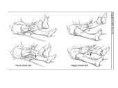 Kineziterapija po kelio sąnario raiščių pažeidimų 9 puslapis